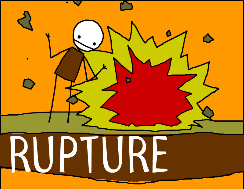 Rupture